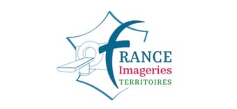 Un réseau de radiologues français conclut un accord avec un fournisseur d'IA pour le diagnostic