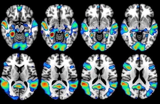 L'IRM fonctionnelle explique les comportements fanatiques à travers celui des supporters de football