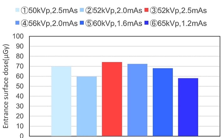 De nouvelles données pour optimiser l'irradiation des nouveau-nés en radiologie mobile