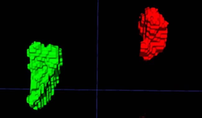 Illustration Des chercheurs américains découvrent un biomarqueur TDM du stress chronique